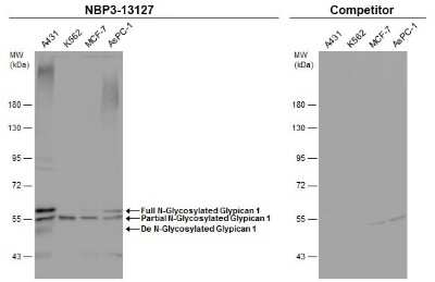 Western Blot: Glypican 1 Antibody [NBP3-13127] - Various whole cell extracts (30 ug) were separated by 7.5% SDS-PAGE, and the membranes were blotted with Glypican 1 antibody (NBP3-13127) diluted at 1:500 and competitor's antibody diluted at 1:500. The HRP-conjugated anti-rabbit IgG antibody (NBP2-19301) was used to detect the primary antibody.