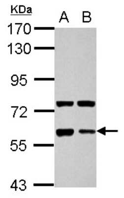 Western Blot: Glypican 5 Antibody [NBP2-14968] - Sample (30 ug of whole cell lysate) A: NT2D1 B: SK-N-SH 7.5% SDS PAGE; antibody diluted at 1:1000.