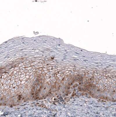 Immunohistochemistry-Paraffin: Glypican 6 Antibody [NBP1-87565] - Staining of human uterine cervix shows moderate membranous positivity in squamous epithelial cells.