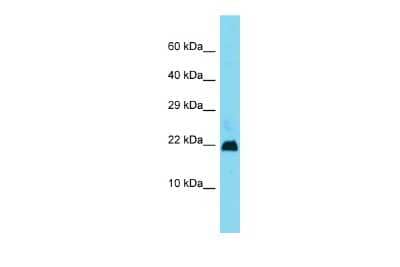 Western Blot: Gm11686 Antibody [NBP3-09434] - Western blot analysis of Gm11686 in Mouse Heart lysates. Antibody dilution at 1.0ug/ml