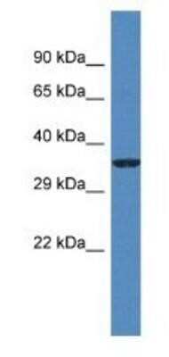 Western Blot: Gm5581 Antibody [NBP1-91491] - Mouse Thymus Lysate 1ug/ml Gel Concentration 12%