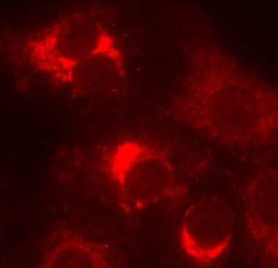 Immunocytochemistry/Immunofluorescence: Goat F(ab')2 anti-Rabbit IgG (H+L) Secondary Antibody [DyLight 550] (Pre-adsorbed) [NBP1-76085] - Cadherin expression in Vero cell using Goat F(ab')2 anti-Rabbit IgG (H+L) Secondary Antibody [DyLight 550] (Pre-adsorbed). Image from verified customer review.