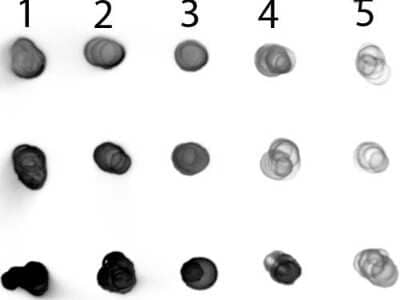 Dot Blot: Goat anti-Human IgA/IgG/IgM (H+L) Secondary Antibody [Alkaline Phosphatase] [NBP1-72622] - Antigen: Row 1 - Human IgG Row 2 - Human IgA Row 3 - Human IgM. Load: Lane 1 - 200 ng Lane 2 - 66.7 ng Lane 3 - 22.2 ng Lane 4 - 7.41 ng Lane 5 - 2.47 ng. Primary antibody: n/a. Secondary antibody: Goat anti-Human IgG IgA IgM Antibody Alkaline Phosphatase Conjugated at 1:1,000 for 1 HR at RT. Blocked with blocking buffer for 60 min at RT.