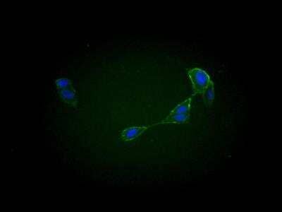Immunocytochemistry/Immunofluorescence: Goat anti-Human IgG (H+L) Secondary Antibody [DyLight 488] (Pre-adsorbed) [NBP1-72861] - Human cancer cell line. Image from verified customer review.