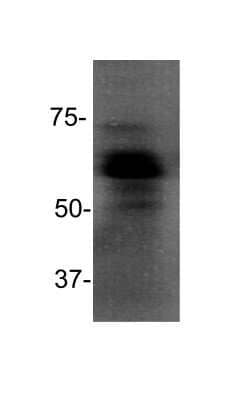 Western Blot: Goat anti-Mouse IgG (H+L) Secondary Antibody [HRP] (Pre-adsorbed) [NB7570] - Analysis of Jurkat cell lysate using anti-MBD1 antibody (Cat. # NB100-56537) followed by Goat anti-Mouse IgG (H+L) Secondary Antibody [HRP] (Pre-adsorbed). Image from verified customer review.