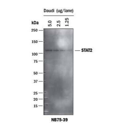 Western Blot: Goat anti-Mouse IgG (H+L) Secondary Antibody [HRP] [NB7539] - Goat anti-Mouse IgG (H+L) Secondary Antibody [HRP] [NB7539]