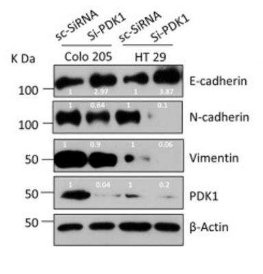 Western Blot: Goat anti-Mouse IgG (H+L) Secondary Antibody [HRP] [NB7539] - Western blots showing a reduction in epithelial mesenchymal transition (EMT) markers upon PDK1 knockdown in Colo205 and HT29 cells using E cadherin (NBP2-19051), N cadherin (NBP1-48309) and B-actin antibody (NB600-501). The corresponding secondary antibodies used were either goat anti-rabbit IgG-HRP (NB7160) or goat anti-mouse IgG-HRP (NB7539). Image collected and cropped by CiteAb from the following publication (//pubmed.ncbi.nlm.nih.gov/33738242) licensed under a CC-BY license.