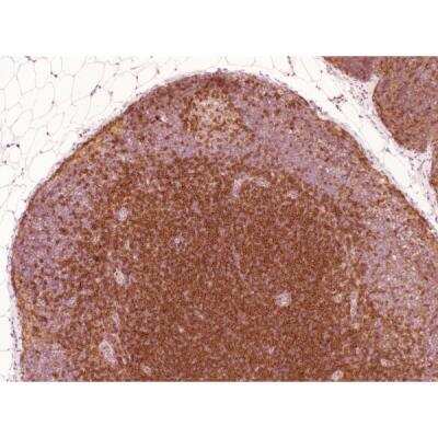 Immunohistochemistry: Goat anti-Mouse IgG ImmPRESS(TM) Secondary Antibody [HRP Polymer] [MP-7452-NB] - Rhesus macaque formalin/paraffin lymph node: CD4 (1F6), ImmPRESS Anti-Mouse Ig Kit, ImmPACT DAB substrate (brown). Hematoxylin counterstain (blue). Courtesy of Charles Brown, NIH, NIAID, Laboratory of Molecular Microbiology.