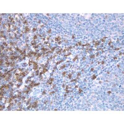 Immunohistochemistry: Goat anti-Mouse IgG ImmPRESS(TM) Secondary Antibody [HRP Polymer] [MP-7452-NB] - Tonsil: CD8 (m), ImmPRESS Anti-Mouse Ig Kit, DAB Substrate Kit (brown). Hematoxylin QS counterstain (blue).