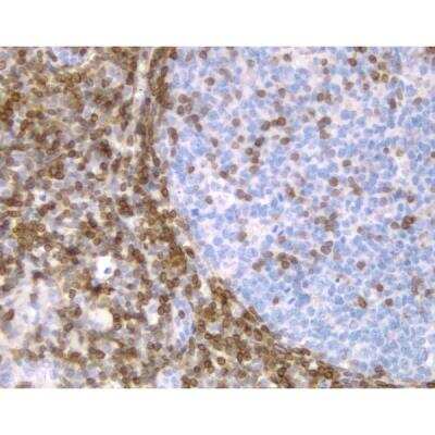 Immunohistochemistry: Goat anti-Mouse IgG ImmPRESS(TM) Secondary Antibody [HRP Polymer] [MP-7452-NB] - Tonsil: Bcl-2 (m), ImmPRESS Anti-Mouse Ig Kit, DAB Substrate Kit (brown). Hematoxylin QS counterstain (blue).