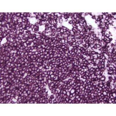 Immunohistochemistry: Goat anti-Mouse IgG ImmPRESS(TM) Secondary Antibody [HRP Polymer] [MP-7452-NB] - Tonsil: CD20 (m), ImmPRESS Anti-Mouse Ig Kit, ImmPACT VIP (purple) substrate