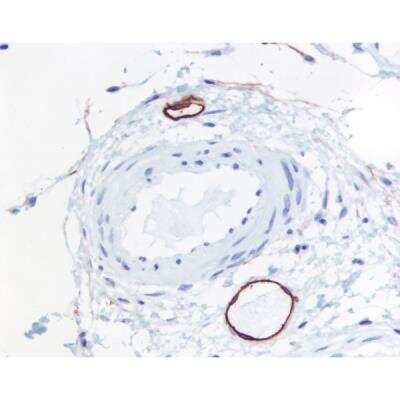 Immunohistochemistry: Goat anti-Mouse IgG ImmPRESS(TM) Secondary Antibody [HRP Polymer] [MP-7452-NB] - Colon submucosa: Lymphatic endothelium stained using mouse monoclonal antibody against M2A antigen (clone D2-40), ImmPress anti-mouse Ig reagent, and Vector NovaRED peroxidase substrate (red). Hematoxylin QS counterstain