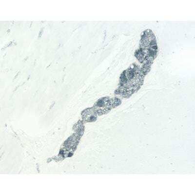 Immunohistochemistry: Goat anti-Mouse IgG ImmPRESS(TM) Secondary Antibody [HRP Polymer] [MP-7452-NB] - Colon: PGP 9.5 (m, VP-P983), ImmPRESS Anti-Mouse Ig Kit, ImmPACT SG (blue-gray) substrate.