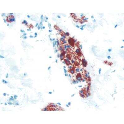 Immunohistochemistry: Goat anti-Mouse IgG ImmPRESS(TM) Secondary Antibody [HRP Polymer] [MP-7452-NB] - Colon: Peripherin (m, VP-P968), ImmPRESS Anti-Mouse Ig Kit, ImmPACT AEC (red) substrate