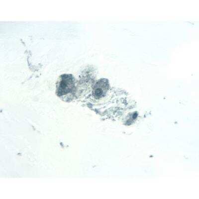 Immunohistochemistry: Goat anti-Mouse IgG ImmPRESS(TM) Secondary Antibody [HRP Polymer] [MP-7452-NB] - Colon: PGP 9.5, ImmPRESS Anti-Mouse Ig Kit, ImmPACT SG (blue-gray) substrate.