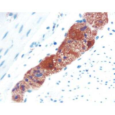 Immunohistochemistry: Goat anti-Mouse IgG ImmPRESS(TM) Secondary Antibody [HRP Polymer] [MP-7452-NB] - Colon: PGP 9.5 (m, VP-P983), ImmPRESS Anti-Mouse Ig Kit, ImmPACT AEC (red) substrate. Hematoxylin QS (blue) counterstain.