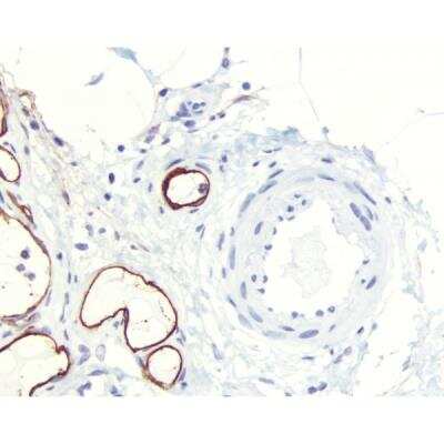 Immunohistochemistry: Goat anti-Mouse IgG ImmPRESS(TM) Secondary Antibody [HRP Polymer] [MP-7452-NB] - Colon submucosa: Lymphatic endothelium stained using mouse monoclonal antibody against M2A antigen (clone D2-40;), ImmPress anti-mouse Ig reagent, and Vector NovaRED peroxidase substrate (red). Hematoxylin QS counterstained