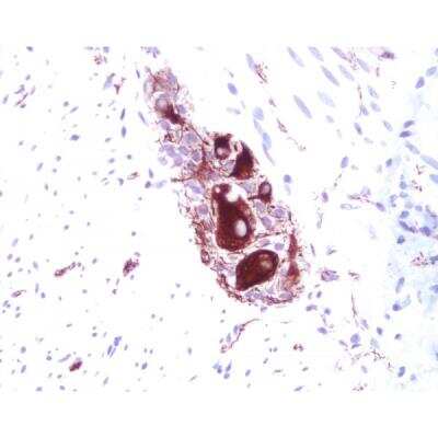 Immunohistochemistry: Goat anti-Mouse IgG ImmPRESS(TM) Secondary Antibody [HRP Polymer] [MP-7452-NB] - Small Bowel: Peripherin (m), ImmPRESS Anti-Mouse Ig Kit, Vector NovaRED Substrate Kit (red). Hematoxylin QS Counterstain (blue).