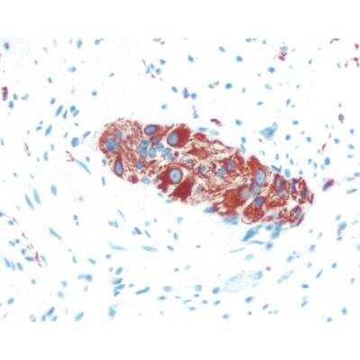 Immunohistochemistry: Goat anti-Mouse IgG ImmPRESS(TM) Secondary Antibody [HRP Polymer] [MP-7452-NB] - Colon: Peripherin, ImmPRESS Anti-Mouse Ig Kit, ImmPACT AEC (red) substrate.