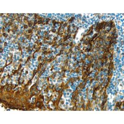 Immunohistochemistry: Goat anti-Mouse IgG ImmPRESS(TM) Secondary Antibody [HRP Polymer] [MP-7452-NB] - Tonsil: Cytokeratin (m), ImmPRESS Anti-Mouse Ig Kit, ImmPACT DAB (brown) substrate. Hematoxylin (blue) counterstain.