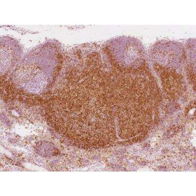 Immunohistochemistry: Goat anti-Mouse IgG ImmPRESS(TM) Secondary Antibody [HRP Polymer] [MP-7452-NB] - Rhesus macaque formalin/paraffin lymph node: CD4 (1F6), ImmPRESS Anti-Mouse Ig Kit, ImmPACT DAB substrate (brown). Hematoxylin counterstain (blue). Courtesy of Charles Brown, NIH, NIAID, Laboratory of Molecular Microbiology.