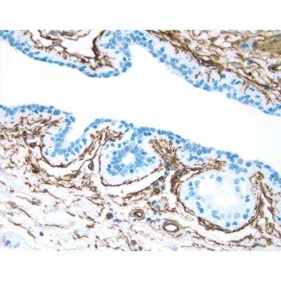 Immunohistochemistry: Goat anti-Mouse IgG ImmPRESS(TM) Secondary Antibody [HRP Polymer] [MP-7452-NB] - Breast: CD34 (m), ImmPRESS Anti-Mouse Ig Kit, DAB Substrate Kit (brown). Hematoxylin counterstain (blue).