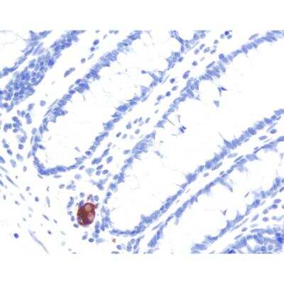 Immunohistochemistry: Goat anti-Mouse IgG ImmPRESS(TM) Secondary Antibody [HRP Polymer] [MP-7452-NB] - Colon: Peripherin, ImmPRESS Anti-Mouse Ig Kit, ImmPACT NovaRED (red) substrate. Hematoxylin QS (blue) counterstain.