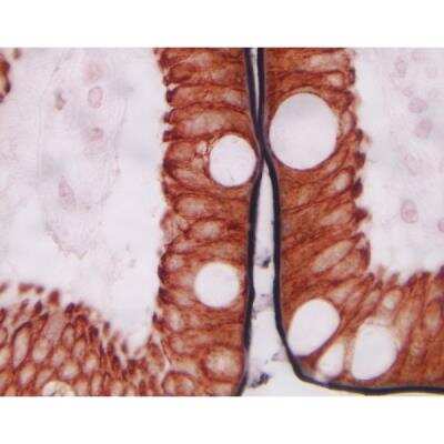 Immunohistochemistry: Goat anti-Mouse IgG ImmPRESS(TM) Secondary Antibody [HRP Polymer] [MP-7452-NB] - Small Intestine (double label): ImmPRESS Anti-Mouse Ig using CD10 primary antibody with DAB/Ni (black) substrate, and ImmPRESS Anti-Mouse Ig using Cytokeratin 20 primary antibody with Vector NovaRED (red) substrate. No counterstain.