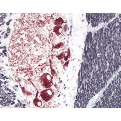 Immunohistochemistry: Goat anti-Mouse IgG ImmPRESS(TM) Secondary Antibody [HRP Polymer] [MP-7452-NB] - Small Bowel (double label): Peripherin (m), ImmPRESS Anti-Mouse Ig Kit, Vector NovaRED (red) substrate. Desmin (m), ImmPRESS Anti-Mouse Ig Kit, DAB/Ni (black) substrate.