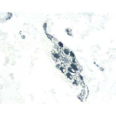 Immunohistochemistry: Goat anti-Mouse IgG ImmPRESS(TM) Secondary Antibody [HRP Polymer] [MP-7452-NB] - Colon: Peripherin (m, VP-P968), ImmPRESS Anti-Mouse Ig Kit, ImmPACT SG (blue-gray) substrate.