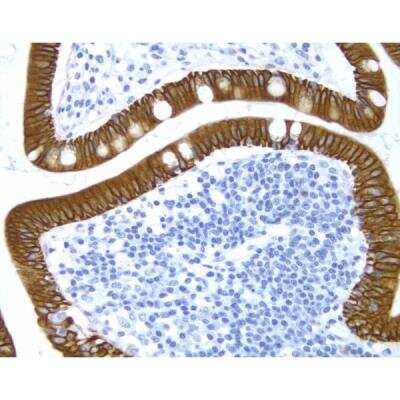 Immunohistochemistry: Goat anti-Mouse IgG ImmPRESS(TM) Secondary Antibody [HRP Polymer] [MP-7452-NB] - Small Bowel: Cytokeratin 8/18 (m), ImmPRESS Anti-Mouse Ig Kit, DAB Substrate Kit (brown), Hematoxylin QS (blue).