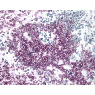 Immunohistochemistry: Goat anti-Mouse IgG ImmPRESS(TM) Secondary Antibody [HRP Polymer] [MP-7452-NB] - onsil (double label): CD3 (m), ImmPRESS Anti-Mouse Ig Reagent, Vector VIP substrate (purple); Ki67 (m), ImmPRESS Anti-Mouse Ig Reagent, Vector SG substrate (blue/gray).