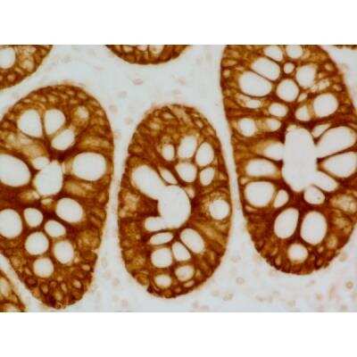 Goat anti-Mouse IgG ImmPRESS(TM) Secondary Antibody [HRP Polymer] [MP-7452-NB] - Colon: anti-Cytokeratin AE1/AE3 (mouse MAb), ImmPRESS HRP Anti-Mouse IgG (made in goat), DAB Substrate Kit (brown).