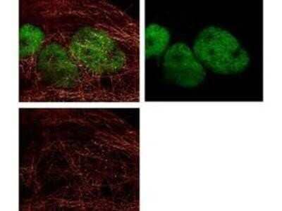 Immunocytochemistry/Immunofluorescence: Goat anti-Rabbit IgG (H+L) Secondary Antibody [DyLight 488] (Pre-adsorbed) [NBP1-72944] - DyLight 488 conjugated anti-Rabbit IgG was used to demonstrate 2 color STED immunofluorescence microscopy. Methanol fixed A431 cells were blocked with normal goat serum. The cells were then probed with 0.4 ug/mL final concentration of anti-HDAC and detected with 0.2 ug/mL DyLight488 conjugated Anti-RABBIT IgG [GOAT] secondary antibody (colored GREEN). Also shown in this 2-color STED image is  a-tubulin monoclonal antibody [MOUSE] detected with ATTO 425 conjugated anti-MOUSE IgG [GOAT] secondary antibody (colored RED).