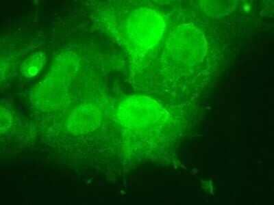 Immunocytochemistry/Immunofluorescence: Goat anti-Rabbit IgG (H+L) Secondary Antibody [DyLight 488] (Pre-adsorbed) [NBP1-72944] - Myosin expression in HeLa cells. Cells were fixed in 4% paraformaldehyde for 20 minutes at room temperature. The secondary antibody was diluted in 1% BSA in PBS at 1:500 and incubated for 20 minutes at room temperature. Image from verified customer review.