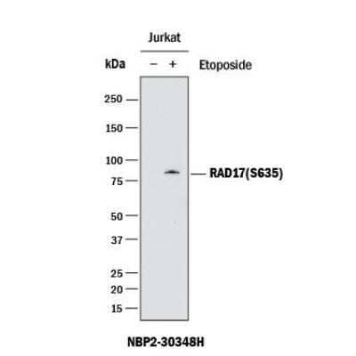 Western Blot: Goat anti-Rabbit IgG (H+L) Secondary Antibody [HRP] [NBP2-30348H] - Western Blot: Goat anti-Rabbit IgG (H+L) Secondary Antibody [HRP] [NBP2-30348H]
