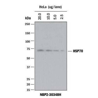 Western Blot: Goat anti-Rabbit IgG (H+L) Secondary Antibody [HRP] [NBP2-30348H] - Western Blot: Goat anti-Rabbit IgG (H+L) Secondary Antibody [HRP] [NBP2-30348H]