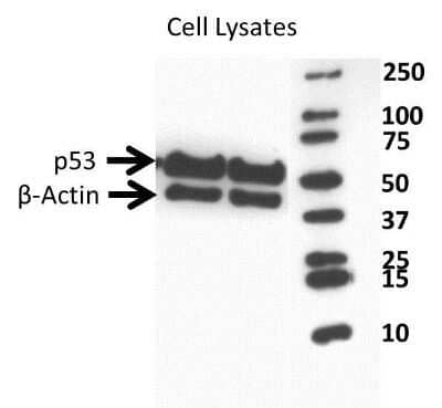 Western Blot: Goat anti-Rabbit IgG (H+L) Secondary Antibody [HRP] [NBP2-30348H] - Western Blot: Goat anti-Rabbit IgG (H+L) Secondary Antibody [HRP][NBP2-30348H]