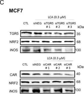 Western Blot: Goat anti-Rabbit IgG (H+L) Secondary Antibody (Pre-adsorbed) [NB7186] - An inhibitor of EZH2 reactivates miR-125b-1 in MCF7 breast cancer cells. To determine the dose of GSK126 that reduces H3K27me3 levels, we treated the breast cell lines with different GSK126 concentrations and performed Western blot analysis. Image collected and cropped by CiteAb from the following publication (//springerplus.springeropen.com/articles/10.1186/s40064-016-2475-z), licensed under a CC-BY license.