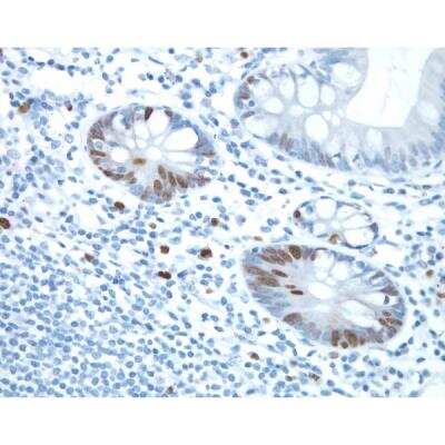 Immunohistochemistry: Goat anti-Rabbit IgG ImmPRESS(TM) Secondary Antibody [HRP Polymer] [MP-7451-NB] - Small bowel: ImmPRESS Anti-Rabbit Ig and DAB (brown) staining using Ki67 primary antibody. Hematoxylin counterstain (blue).