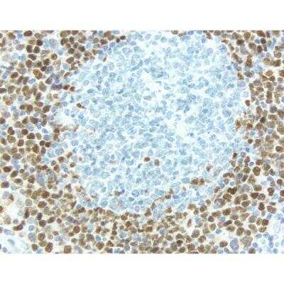 Immunohistochemistry: Goat anti-Rabbit IgG ImmPRESS(TM) Secondary Antibody [HRP Polymer] [MP-7451-NB] - Lymph Node: Cyclin D1 (rm), ImmPRESS Anti-Rabbit Ig Kit, DAB (brown) substrate. Hematoxylin QS (blue) counterstain.