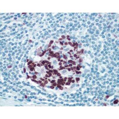 Immunohistochemistry: Goat anti-Rabbit IgG ImmPRESS(TM) Secondary Antibody [HRP Polymer] [MP-7451-NB] - Peyers Patch: ImmPRESS anti-rabbit Ig using Ki67 rabbit primary antibody with Vector NovaRed (red) substrate. Hematoxylin QS counterstain (blue).