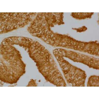 Immunohistochemistry: Goat anti-Rabbit IgG ImmPRESS(TM) Secondary Antibody [HRP Polymer] [MP-7451-NB] - Prostate: anti-PSA (rabbit MAb), ImmPRESS HRP Anti-Rabbit IgG (made in goat), DAB Substrate Kit (brown).