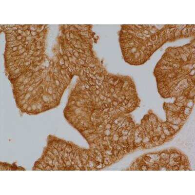 Immunohistochemistry: Goat anti-Rabbit IgG ImmPRESS(TM) Secondary Antibody [HRP Polymer] [MP-7451-NB] - Prostate: anti-PSA (rabbit MAb), ImmPRESS HRP Anti-Rabbit IgG (made in goat), DAB Substrate Kit (brown).