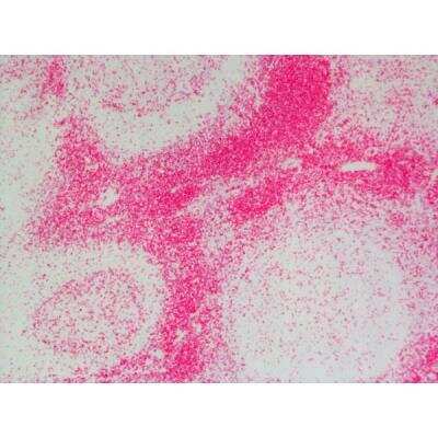 Immunohistochemistry: Goat anti-Rat IgG ImmPRESS(TM) Secondary Antibody [MP-5404-NB] - Tonsil: Anti-CD3 (rat monoclonal), ImmPRESS-AP Anti-Rat IgG, Vector Red Substrate