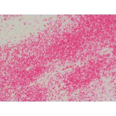 Immunohistochemistry: Goat anti-Rat IgG ImmPRESS(TM) Secondary Antibody [MP-5404-NB] - Tonsil: Anti-CD3 (rat monoclonal), ImmPRESS-AP Anti-Rat IgG, Vector Red Substrate