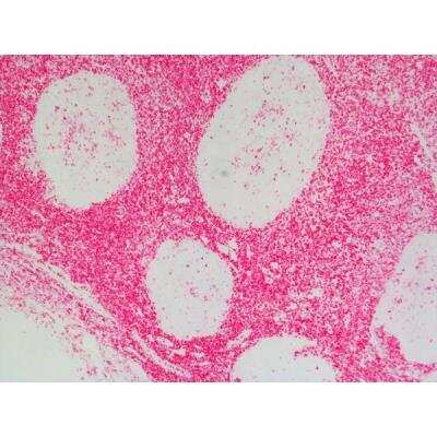 Immunohistochemistry: Goat anti-Rat IgG ImmPRESS(TM) Secondary Antibody [MP-5404-NB] - Tonsil: Anti-CD45 (rat monoclonal), ImmPRESS-AP Anti-Rat IgG, Vector Red Substrate.