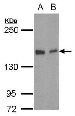 Western Blot: Golgi Glycoprotein 1/GLG1 Antibody [NBP2-16704] -  Sample (30 ug of whole cell lysate) A: NT2D1 B: SK-N-SH 5% SDS PAGE gel, diluted at 1:1000.
