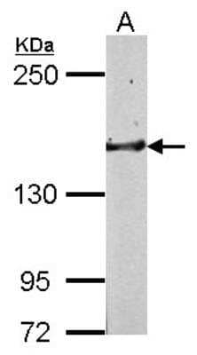 Western Blot: Golgi Glycoprotein 1/GLG1 Antibody [NBP2-16704] - Sample (50 ug of whole cell lysate) A: Mouse Brain, 5% SDS PAGE gel, diluted at 1:1000.