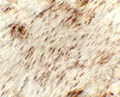 Immunohistochemistry Golgin 97 Antibody - BSA Free